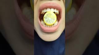 ASMR Magic "Lemon Slice Candy" Turns into a Sweet Surprise! #short #shorts 1008