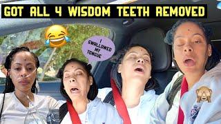 **MUST WATCH** All 4 Wisdom Teeth Removed & Was OUT OF MY MIND.