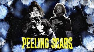 ZILLAKAMI & SOSMULA - PEELING SCABS/ШЕЛУШАЩИЕСЯ СТРУПЬЯ [ПЕРЕВОД]