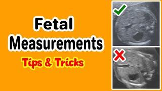 Fetal Measurements, Tips and Tricks