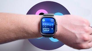 Discover the New Vitals App in watchOS 11 | MAJOR Apple Watch Update!