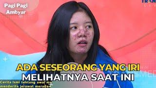 Namanya ISMI, Konten KREATOR Yang Alami Hal TAK Mengenakan | PAGI PAGI AMBYAR (2/2/23) P3