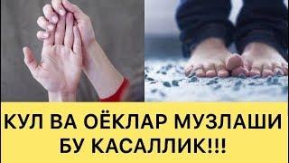 ХАММА КЎРСИН!!! ҚЎЛ ВА ОЁҚЛАР МУЗЛАШИ БУ КАСАЛЛИКДАН ДАРАК БЕРАДИ