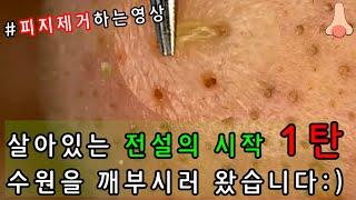 피지 직접 뽑아드렸습니다 _ 피지제거 블랙헤드제거 피지뽑기 _ 경기도 수원에 살아있는 전설을 모시고 피지를 개박살 내주고 왔습니다 1탄