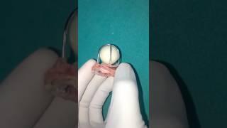 Amazing Prosthetic Heart Valve 🫀#goodtoknow #vet #medicine #surgeonlife #prosthetic #surgery #hack
