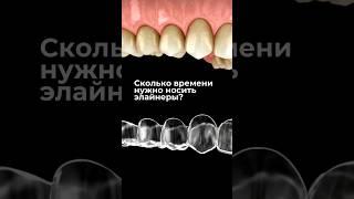 Сколько времени нужны носить элайнеры? #элайнеры #брекеты