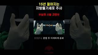 15년 젊어지는 지방줄기세포 주사( ※실제 시술 장면※)