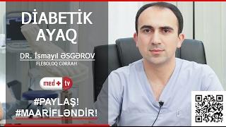 Diabetik ayaq Dr Ismayil ESGEROV Fleboloq Cerrah