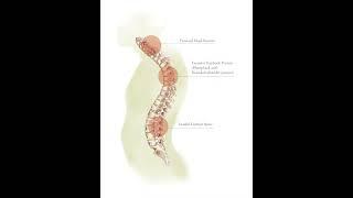 abnormal spinal curvature#trending #viral #youtubeshorts #fitness #tips #medical