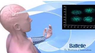 Battelle NeuroLife® Neural Bypass Technology