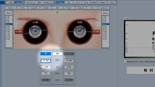 Phoropter module for the Thomson Test Chart: General overview