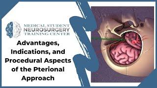 Advantages, Indications, and Procedural Aspects of the Pterional Approach