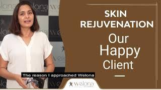 Acne & Acne scars removal journey with Welona clinic | Client review | Skin rejuvenation treatment