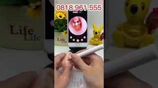 Dụng Cụ Lấy Ráy Tai Có Camera Nội Soi Đa Năng Hình Ảnh Sắc Nét Bảo Hành 12 Tháng