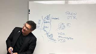 Skew deviation pathophysiology