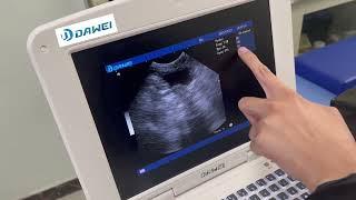 Vet Ultrasound Machine- Compact, Clear, and Convenient!