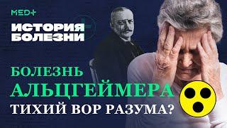 Потеря памяти, рассеянность, нарушение речи: болезнь Альцгеймера | История болезни