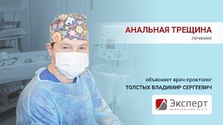 Лечение анальной трещины