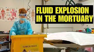 Fluid explosion in the mortuary