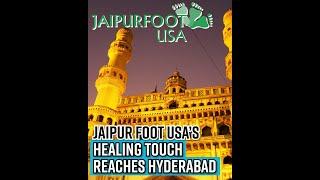 Jaipur Foot USA's next stop in Hyd; historic limb fitment camp to mark 75 years of Independence