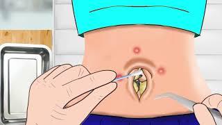 ASMR Remove Navel Stone Animation The girl's navel is dirty and stinks 오래된 배꼽 팅글 느껴지는 애니메이션 #1