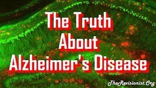 Alzheimer's Disease Symptoms & Pathology Characteristics - Part 1