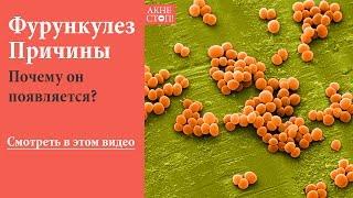 Фурункулез причины – ПОЧЕМУ он появляется? Смотрите в этом видео