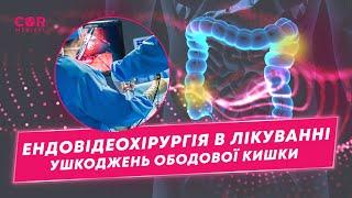 Ендовідеохірургія в лікуванні поранень черевної порожнини