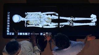 Revealed: How King Tut Died