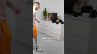 Как реагируют дети на протез ноги