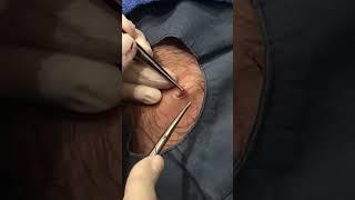 As promised here is CYST #2 from the family of popaholics!