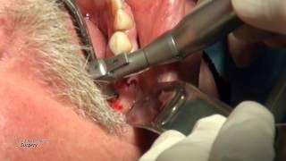 Dental Case 04 - Dr. Alexander V. Antipov