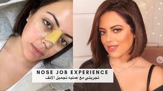 MY NOSE JOB | صمود المؤمن | تجربتي مع عمليه الانف