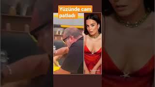 Aslı Bekiroğlu'nun yüzünde cam sebil patladı