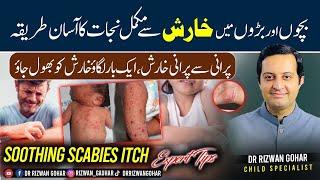 How to stop itching with expert advice #Scabies #treatment