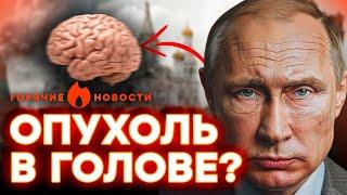 В КРЕМЛЕ раскрыли ТАЙНУ МОЗГОВ ПУТИНА, а депутат ГОСДУМЫ разгневала... | ГОРЯЧИЕ НОВОСТИ 06.08.2024