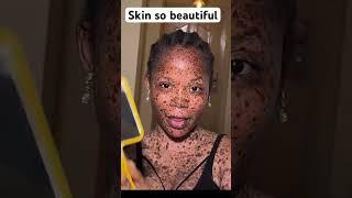 She’s just so beautiful…. #explore #skin #freckles #trending #trendingshorts