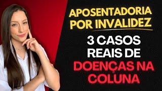 APOSENTADORIA POR INVALIDEZ: 3 CASOS REAIS DE INCAPACIDADE POR DOENÇAS NA COLUNA