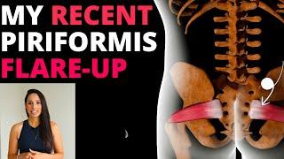 Piriformis Syndrome: How To Quickly Settle A Flare-Up (Exercise & Nutrition)