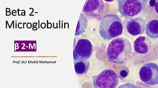 Beta-2 Microglobulin (ß2-M) Test