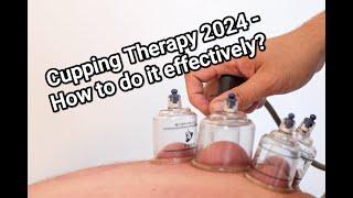 Cupping Therapy   How to do it effectively   clinical tips