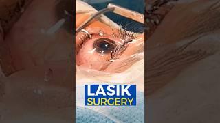 Live Lasik Surgery