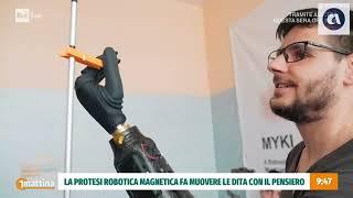 La prima mano robotica con controllo magnetico: progetto finanziato anche da Inail