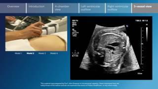 Key screening views of the fetal heart - Part 6 - Vessel view