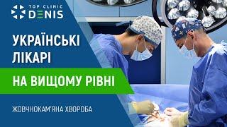 Українські лікарі на вищому рівні - лікування жовчнокам'яної хвороби | TOP Clinic DENIS