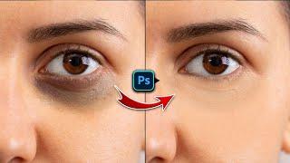 Easy way to Remove Dark Circles in Adobe Photoshop