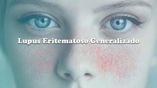 Lupus Eritematoso Generalizado || Medical Toursv