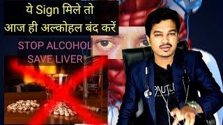 5 sign of liver damage due to Alcohol / Dr. chandrashekhar verma ( mbbs)