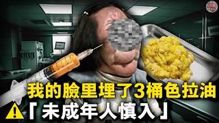 韓國頂流模特神似王祖賢，十年整形上百次親手往臉上打食用油終毀容！17次手術取出3.5公斤異物，你敢看嗎？【迷霧調查組】韓國案件 案件推理 案件分析