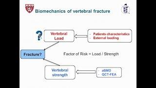 Preventing Spinal Fractures with 3D Computer Models